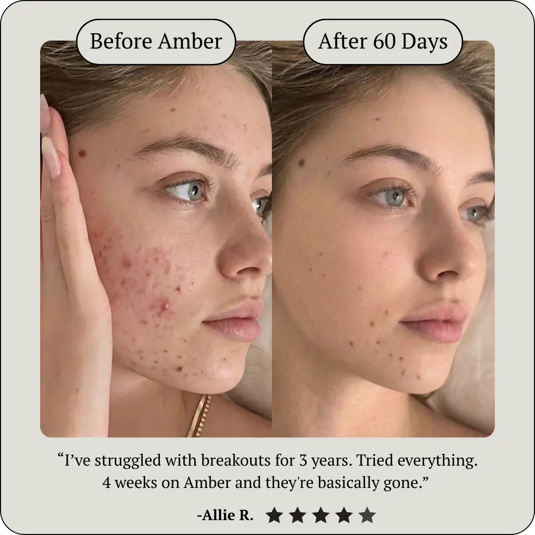 AMBER