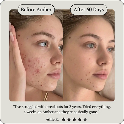 AMBER
